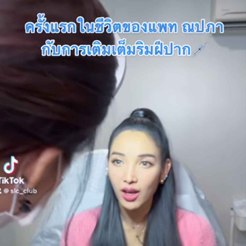 ฉีดปาก_แพท ณปภา_ฟิลเลอร์_Filler_ฉีดปากสายฝอ