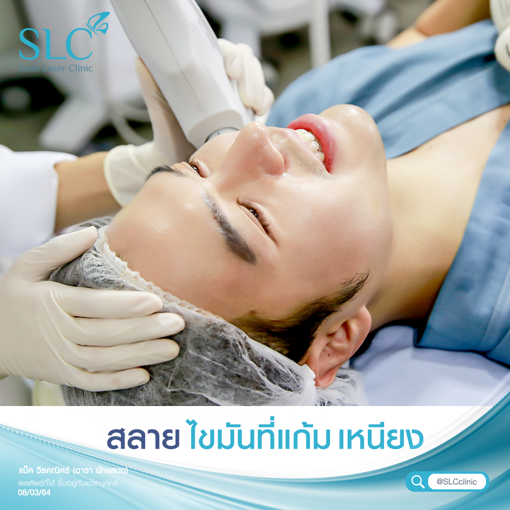 Ultherapy SPT