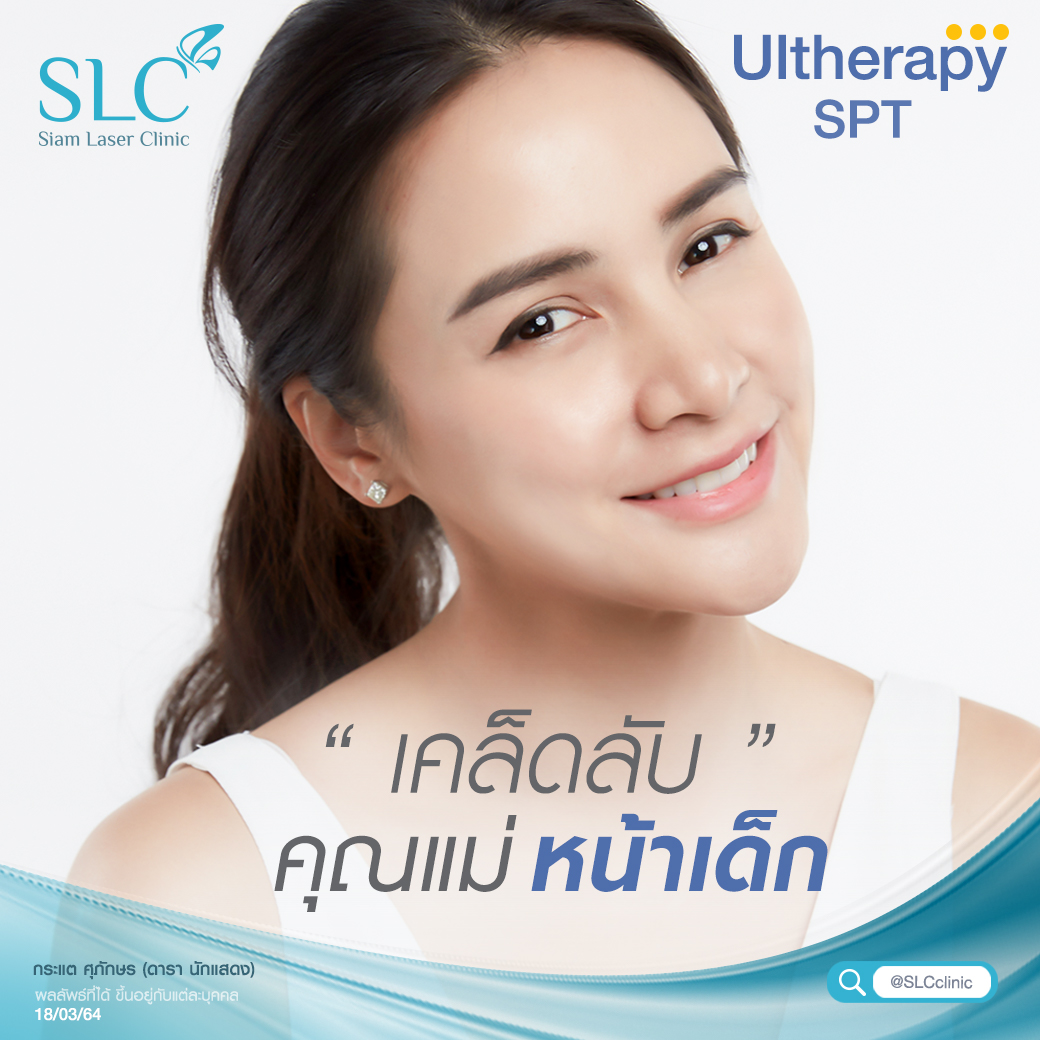 Ultherapy SPT