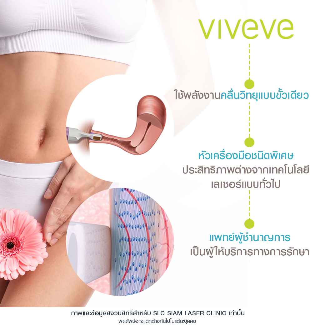 ยกกระชับช่องคลอด_viveve_velashape_สลายไขมัน_ลดหุ่น