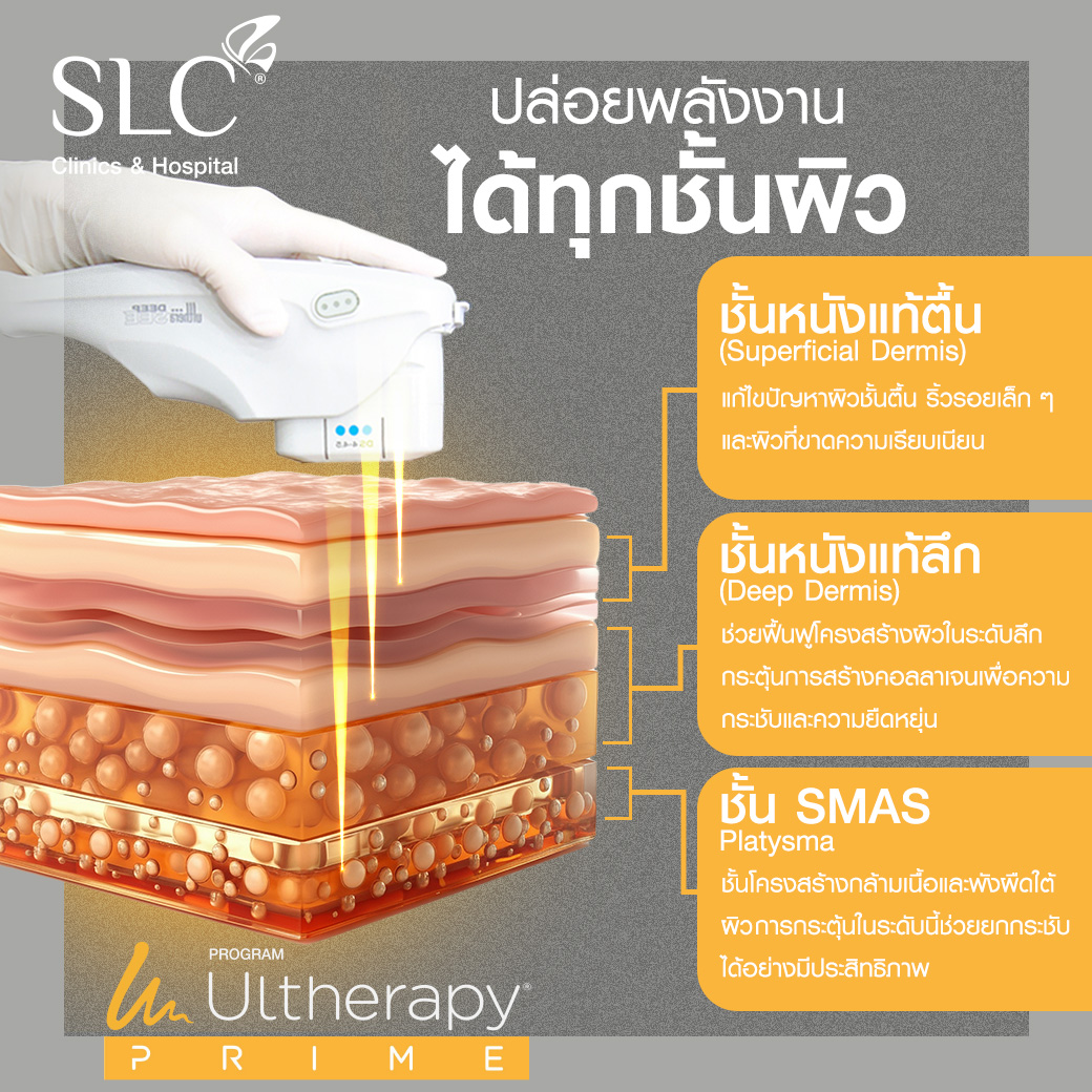 โปรแกรมยกหน้า, หน้าเล็ก สเป็ก KAO, Ultherapy PRIME, อัลเทอราปี ไพรม์, เก้านพเก้า เดชาพัฒนคุณ 
