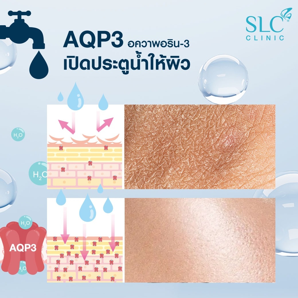 ผิวฉ่ำวาว , Volite , จิ้มหน้าใส , เมโสหน้าใส 