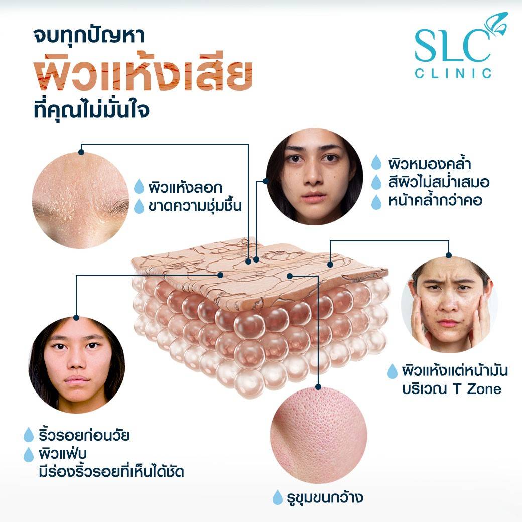 Volite ช่วยเรื่องอะไร