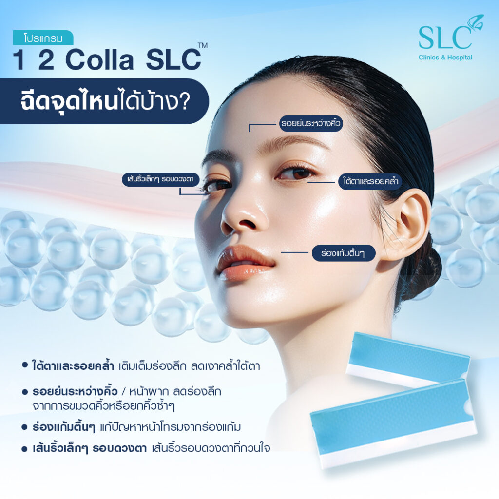 TheraFill®, ฝังคอลลาเจนสด, ผิวหย่อนคล้อย, ริ้วรอย, โปรแกรม 1 2 Colla SLC™ (TheraFill®)