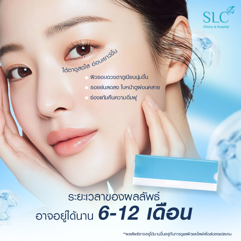 TheraFill®, ฝังคอลลาเจนสด, ผิวหย่อนคล้อย, ริ้วรอย, โปรแกรม 1 2 Colla SLC™ (TheraFill®)