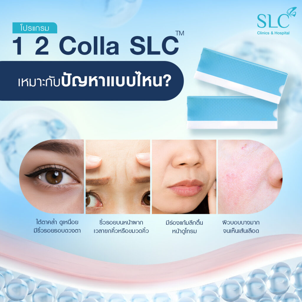 TheraFill®, ฝังคอลลาเจนสด, ผิวหย่อนคล้อย, ริ้วรอย, โปรแกรม 1 2 Colla SLC™ (TheraFill®)