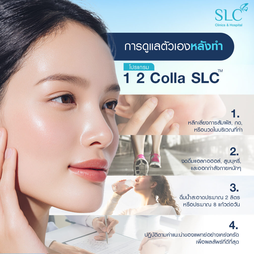 TheraFill®, ฝังคอลลาเจนสด, ผิวหย่อนคล้อย, ริ้วรอย, โปรแกรม 1 2 Colla SLC™ (TheraFill®)