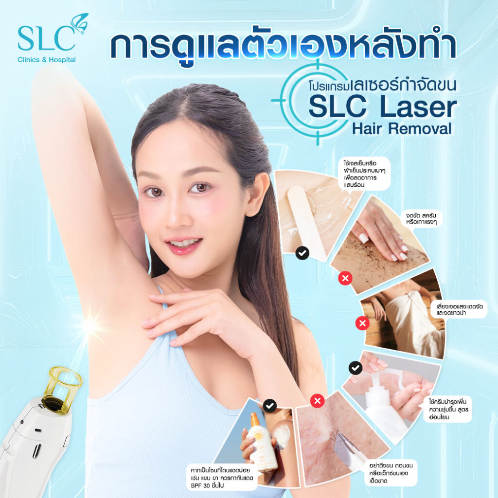 เนียนนานไม่เป็นตอ, ขนคุด, โปรแกรม SLC Laser Hair Removal, เลเซอร์กำจัดขน, ผิวหมองคล้ำ