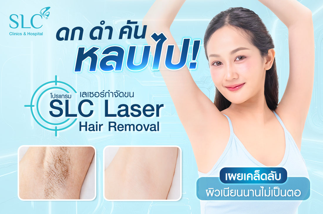 เนียนนานไม่เป็นตอ, ขนคุด, โปรแกรม SLC Laser Hair Removal, เลเซอร์กำจัดขน, ผิวหมองคล้ำ