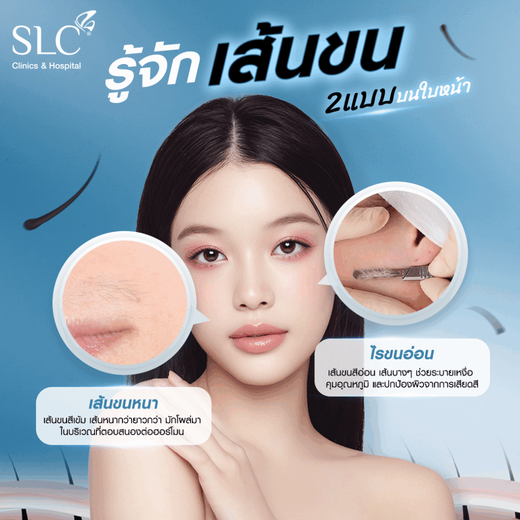 เลเซอร์กำจัดขน, SLC Clinic, SLC Laser Hair Removal Program, เลเซอร์กำจัดขนหน้า, เลเซอร์หนวด, เลเซอร์เครา