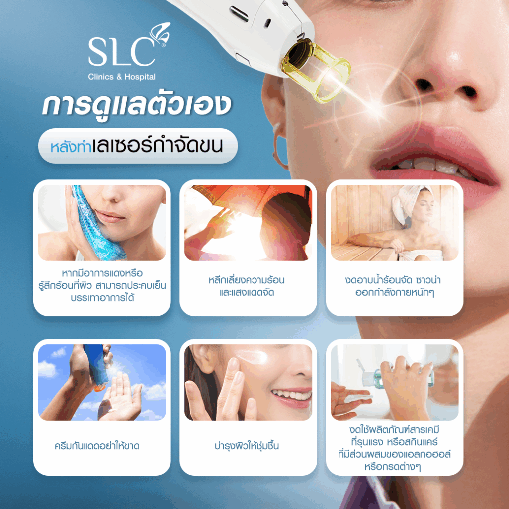 เลเซอร์กำจัดขน, SLC Clinic, SLC Laser Hair Removal Program, เลเซอร์กำจัดขนหน้า, เลเซอร์หนวด, เลเซอร์เครา