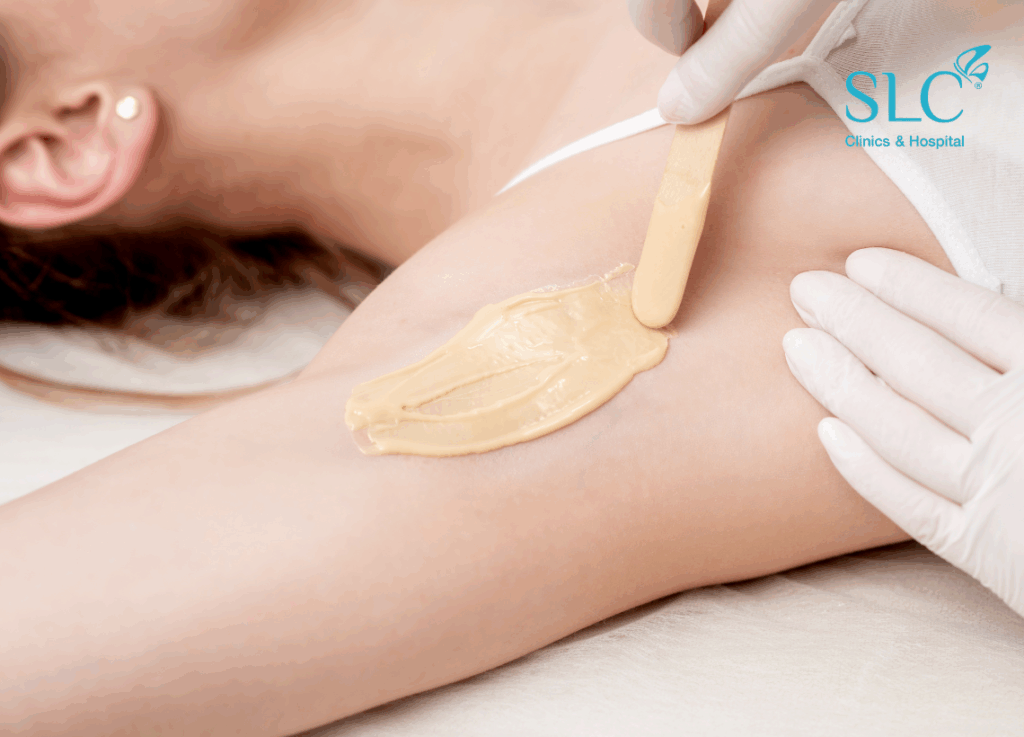 เนียนนานไม่เป็นตอ, ขนคุด, โปรแกรม SLC Laser Hair Removal, เลเซอร์กำจัดขน, ผิวหมองคล้ำ