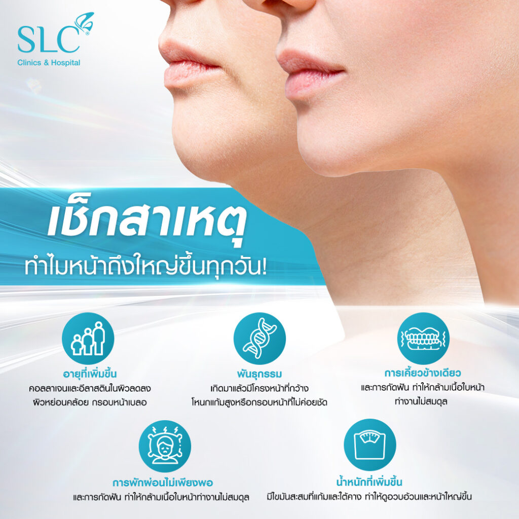 Ultherapy PRIME® ที่ SLC, ยกกระชับหน้า, อยากหน้าเล็ก, หน้าใหญ่ทำไงดี