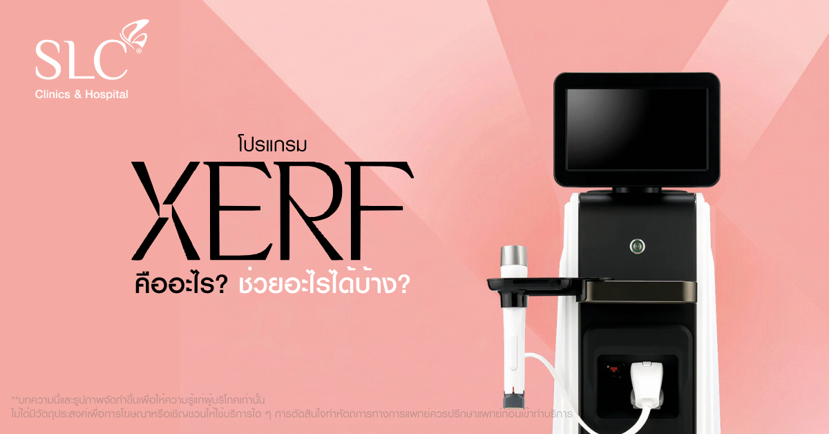 โปรแกรม XERF คืออะไร? เจาะลึกยกกระชับแบบ custom