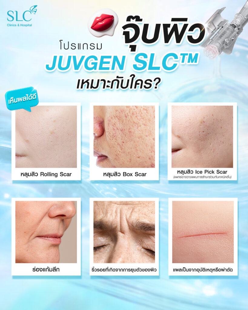 JUVGEN เหมาะกับใคร