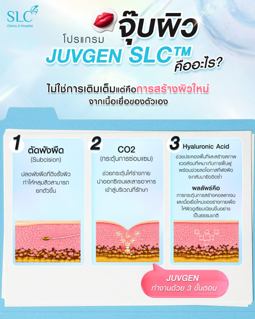 โปรแกรม JUVGEN SLC™