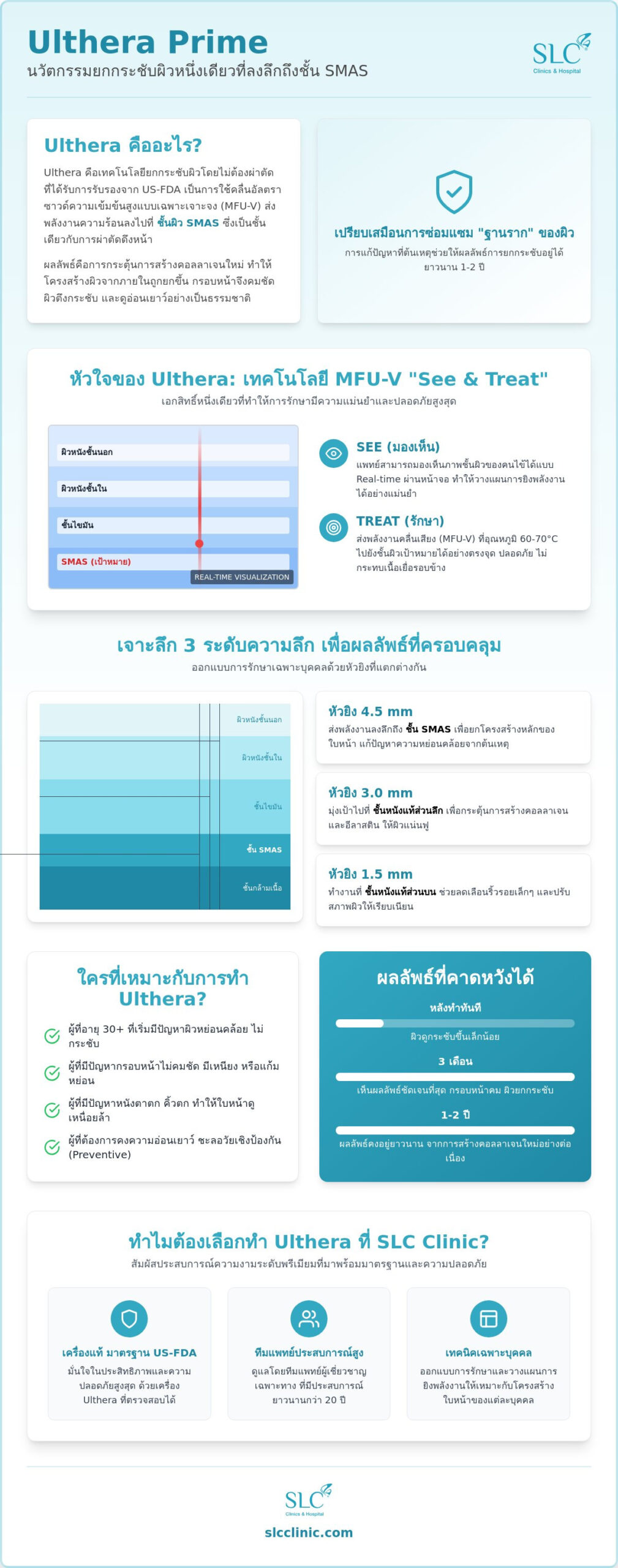 Ulthera คืออะไร? เจาะลึกนวัตกรรมยกกระชับผิวถึงชั้น SMAS ที่ดีที่สุดในปี 2026