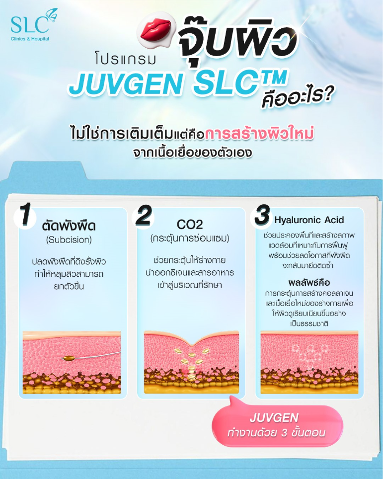 โปรแกรม JUVGEN SLC™