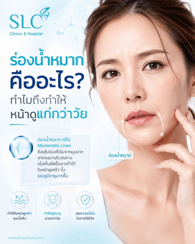 ร่องน้ำหมาก