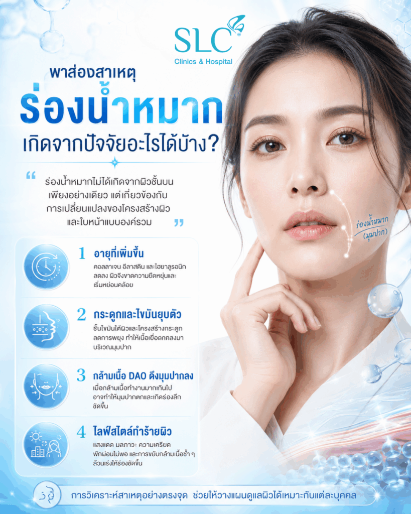 ร่องน้ำหมาก