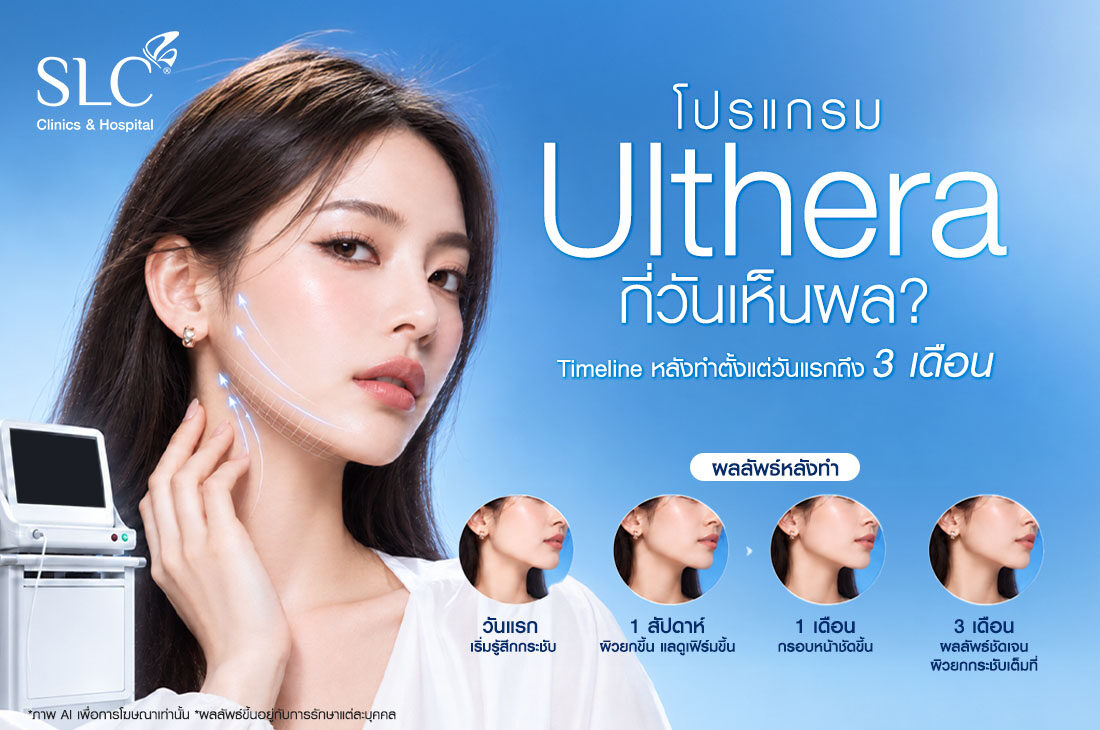 โปรแกรม Ulthera เห็นผลเมื่อไหร่ กี่วันเห็นผล? Timeline หลังทำตั้งแต่วันแรกถึง 3 เดือน